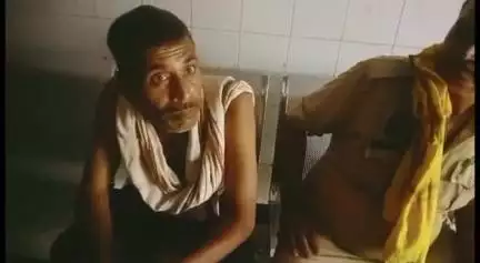 मानिकपुर: मारकुंडी थाना क्षेत्र के इटवां डुडेला में गंदगी फैलाने को लेकर 2 पक्षों में लाठी-डंडे चले, 2 व्यक्ति घायल