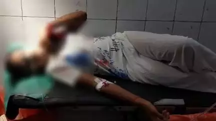पाली: मां-बाप के झगड़े से परेशान होकर किशोरी ने विषैले पदार्थ का सेवन किया, किशोरी को पाली के ट्रॉमा सेंटर में भर्ती किया गया