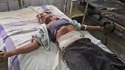 जगदीशपुर: पिस्ता चौक के पास तेज रफ्तार ट्रक ने टोटो को मारी टक्कर, एक मजदूर गंभीर घायल