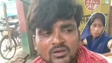 बैरिया: कोटवां में मजदूरी मांगने गए हलवाई की पत्नी को गंदी गालियां दी गईं, पति-पत्नी को बुरी तरह पीटा, मामला बैरिया थाना पहुंचा