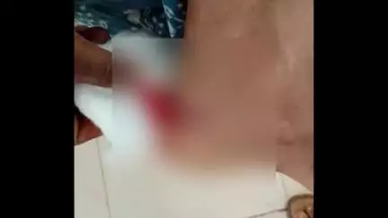 വെെത്തിരി: പൊഴുതന പ്രദേശത്ത് നിരവധി പേർക്ക് തെരുവുനായയുടെ കടിയേറ്റു, അക്രമകാരിയായ നായയെ നാട്ടുകാർ തല്ലിക്കൊന്നു