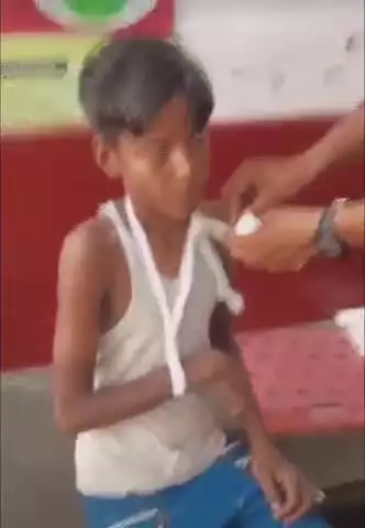 फतेेहपुर: अईम्बा गांव में जामुन तोड़ते समय 12 वर्षीय बच्चा पेड़ से गिरा, हाथ टूटा