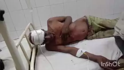 अशोक नगर: सहोदरी गांव में शराबी बेटे ने पिता के सिर में मारा पत्थर, गंभीर रूप से घायल होने पर ज़िला अस्पताल में भर्ती