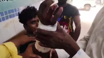 ভগবানগোলা ১: স্ত্রীর সঙ্গে ঝগড়া, রাগের বশে শোকেসে ঘুসি! গুরুতর জখম যুবক ভরতি মেডিক্যালে গোবরা গ্রামের যুবক