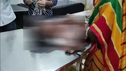 मुफ़सिल थाना क्षेत्र के एक गांव में ढाई साल की बच्ची को कुत्ते ने काटा, सदर अस्पताल में भर्ती