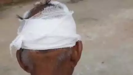 बलिया: बड़ी बलिया उत्तरी में एक व्यक्ति के सिर पर ईंट से हमला, सिर फोड़ा