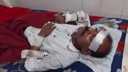 शहपुरा: गुरैया गांव में तेज रफ्तार मोटरसाइकिल अनियंत्रित होकर पलटी, अधेड़ घायल, शहपुरा अस्पताल में इलाज जारी