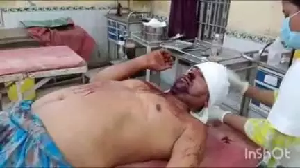 गोपालगंज: तकिया बनकट गांव में छोटे भाई ने बड़े भाई को छत से फेंका, हालत गंभीर