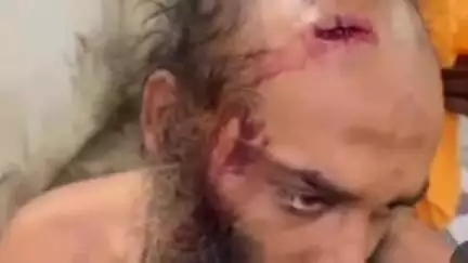 प्रयागराज के मौजगिरी आश्रम के महंत पर ग्वालियर में हमला, हरि गिरि ने मध्यप्रदेश के CM से की बात