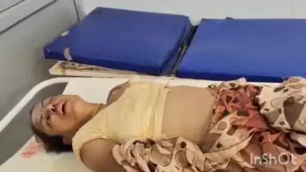 छिबरामऊ: सौरीख रोड स्थित बाबा की बगिया के मोड़ पर तेज रफ्तार अज्ञात वाहन ने बाइक में मारी टक्कर, महिला और युवक घायल