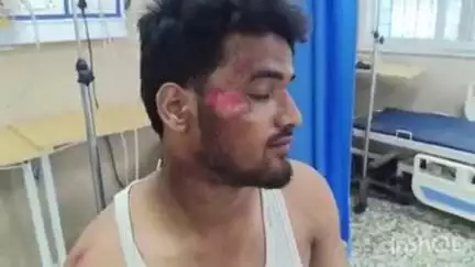 आरा: कवरा गांव के समीप बाइक और स्कॉर्पियो की टक्कर में बाइक सवार छात्र घायल, आरा सदर अस्पताल में कराया गया भर्ती