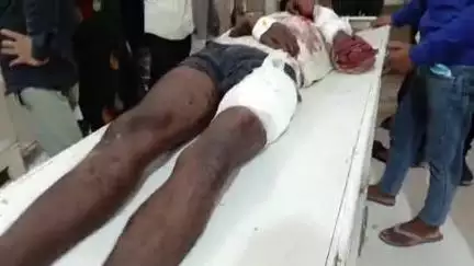 सीतापुर: उदरापुर खुर्द ग्राम पंचायत में तेज रफ्तार मोटरसाइकिल अनियंत्रित होकर खेत में कटीले तारों पर गिरी, व्यक्ति घायल