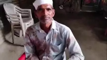 प्रतापगढ़: डड़वा महोखरी गांव में पुरानी रंजिश के चलते जानलेवा हमला, घायल की हालत गंभीर, मेडिकल कॉलेज किया गया रेफर