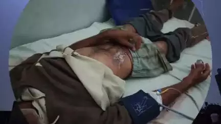 पन्ना: पन्ना में आकाशीय बिजली गिरने से 60 वर्षीय किसान गंभीर रूप से घायल, कई भैंसें भी झुलसीं