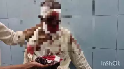 లారీ ఢీకొని రైతు తీవ్రంగా గాయపడ్డ సంఘటన శుక్రవారం రాత్రి మొలకలచెరువులో జరిగిందని ఎస్సై నరసింహుడు తెలిపారు