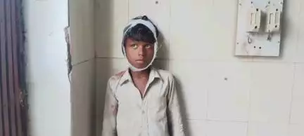 बेलदौर: बेलदौर नगर पंचायत के श्रीपुर गांव में ट्रैक्टर पलटने से एक बालक घायल