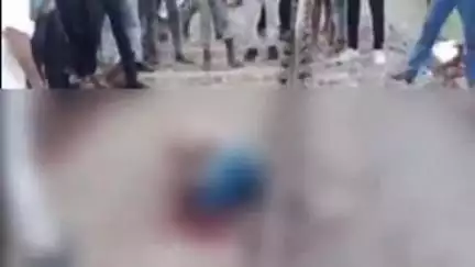 झांसी: झांसी स्टेशन से पहले ट्रेन से गिरे युवक के पैर कटे, गोरखपुर-पनवेल एक्सप्रेस में सफर कर रहा था मुसाफिर, वीडियो वायरल