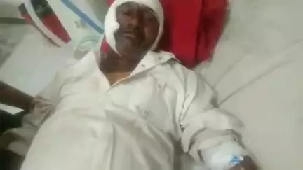 भीलवाड़ा: आमा में रोड पर अचानक पशु के आने से बाइक सवार अनियंत्रित होकर पशु से टकराया, घायल जिला चिकित्सालय में भर्ती