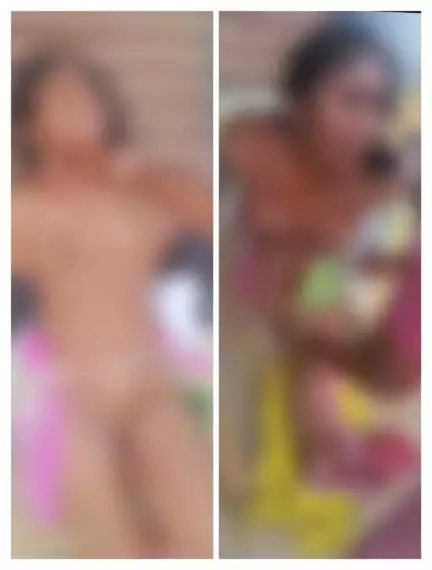హనుమకొండ జిల్లాలో భర్తతో వివాహేతర సంబంధం పెట్టుకుందని మహిళను వివస్త్రను చేసి, ప్రైవేట్‌ పార్ట్‌లో జీడి పోసి కొట్టిన భార్య