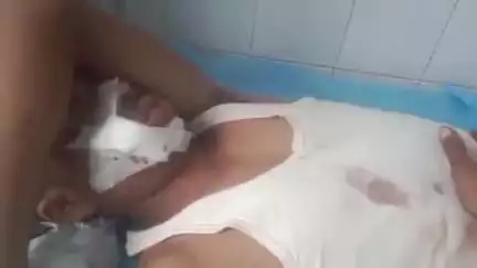 बारां: छजावा पेट्रोल पंप के पास अज्ञात वाहन की टक्कर से बाइक सवार युवक घायल, उपचार के लिए जिला अस्पताल में भर्ती