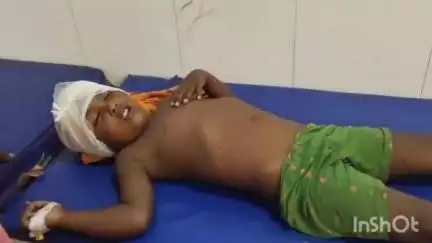 छिबरामऊ: कल्यानपुर का 5 वर्षीय बच्चा छत से गिरकर गंभीर रूप से घायल, हायर सेंटर रेफर किया गया