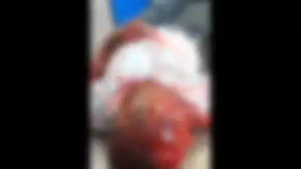 अकलतरा: खटोला नहर के पास 2 बाइक में हुई जोरदार भिड़ंत, एक युवक की मौत, 2 गंभीर रूप से घायल युवकों को बिलासपुर रेफर किया गया