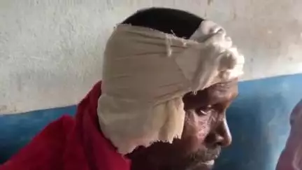 কেশিয়ারি: কামড়ে কান কেটে নেওয়ার অভিযোগে গ্রেপ্তার এক ব্যক্তি কেশিয়াড়িতে
