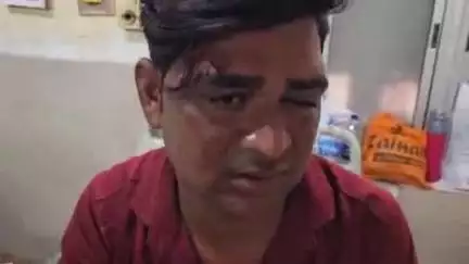 पीपलदा: स्टेट हाइवे 70 पर गणेशगंज के निकट मोटरसाइकिल फिसलने से युवक घायल, MBS अस्पताल में भर्ती, उपचार जारी