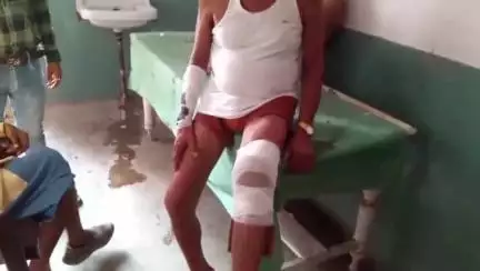 कौंच: भदारी गांव के पास भंडारा खाकर लौट रहे बाइक सवारों को दौड़ती भैंस ने मारी टक्कर, 2 लोग गंभीर रूप से जख्मी