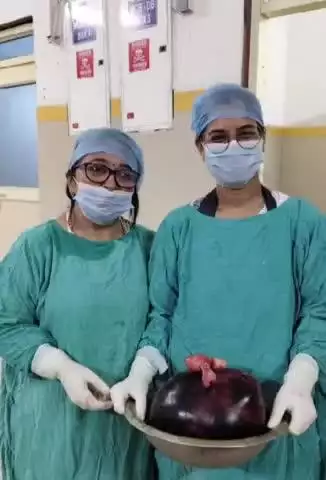 दतिया नगर: 75 वर्षीय महिला के अंडाशय से विशालकाय ट्यूमर निकाला गया, मेडिकल कॉलेज दतिया में हुआ सफल ऑपरेशन