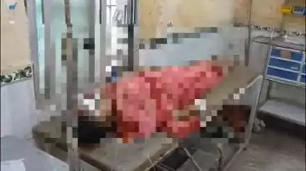 गोपालगंज: बसडीला खाप गांव: महिला ने यूरिया को चीनी समझ चाय बनाकर पी, बिगड़ी तबीयत; अस्पताल में भर्ती