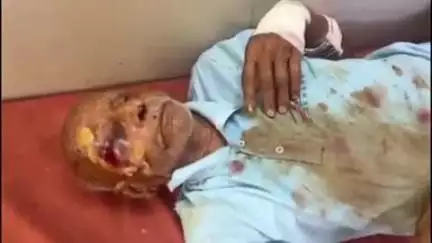 महाराजगंज: बन्नावा के पास अज्ञात वाहन ने साइकिल सवार वृद्ध को मारी जोरदार टक्कर, गंभीर रूप से घायल को ट्रॉमा सेंटर रेफर किया गया