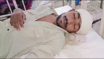 आबापुरा: भोजीया कला गांव के दबंगों ने पूर्व के विवाद को लेकर युवक के सिर पर मारा लट्ठ, एमजी अस्पताल में उपचार जारी