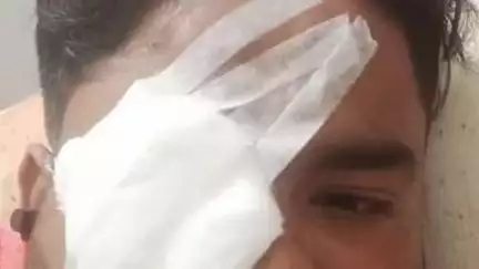बरकागाँव: पैसा मांगने पर मारपीट और गाली गलौज करने के मामले में बड़कागांव थाने में मामला दर्ज