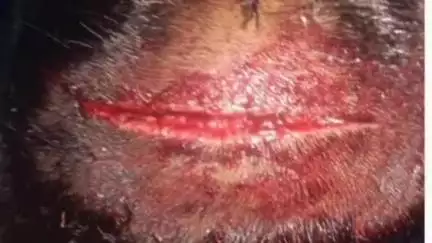 రెడ్డిగూడెంలో భూ వివాదం.. గొడ్డలితో దాడి