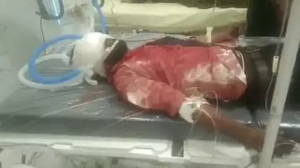 भीलवाड़ा: नानकपुरा के पास कार से बाइक टकराई, बाइक सवार दो युवक हुए घायल, एक को अस्पताल से हायर सेंटर किया रेफर