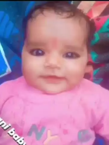 बाह: सांवलदास पुरा गांव में खोलते दलिया के भगोने में गिरी दो साल की मासूम, हालत गंभीर