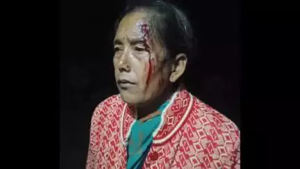 कांडा: कपूरी ग्राम पंचायत के घोड़ाघाड़ में 52 वर्षीय महिला नीमा देवी पर गुलदार ने किया हमला, चेहरा हुआ लहुलुहान