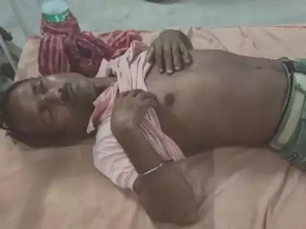 গাজোল: ইমাম নগর বাজার সড়ক এলাকায় ২ বাইক আরোহী নিয়ন্ত্রণ হারিয়ে মুখোমুখি সংঘর্ষের জেরে জখম হয় তিন