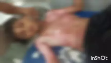 मुंगेर: कासिम बाजार थाना क्षेत्र में पेट्रोल से एक किशोर झुलसा