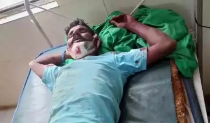 గిద్దలూరు: కొమరోలు మండలం హనుమంతురాయుని పల్లి గ్రామ సమీపంలో ద్విచక్ర వాహనం అదుపుతప్పి ఓ యువకుడికి తీవ్ర గాయాలు, ఆసుపత్రికి తరలింపు