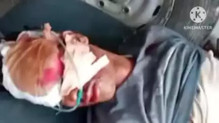 नरपतगंज: पोसदाहा में अनियंत्रित बाइक सवार युवक गिरकर गंभीर रूप से घायल