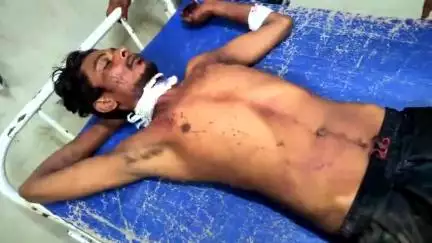 बेतिया: नौरंगाबाद डोमटोली में पारिवारिक कलह में युवक ने काटा गला, जीएमसीएच में भर्ती, इलाज जारी