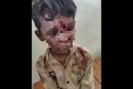 बलरामपुर: लखाही गांव में 7 साल के मासूम को शौचालय में बंद कर युवकों ने बेरहमी से पीटा, गंभीर हालत में अस्पताल में भर्ती