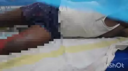 नवादा: फरहा गांव में सिलेंडर में आग लगने से एक युवक झुलसा, अस्पताल में कराया गया इलाज