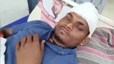 नरसिंहपुर: झगरयाई गांव में मामूली विवाद को लेकर दो पक्षों के बीच चले लाठी-डंडे, दो लोग हुए घायल