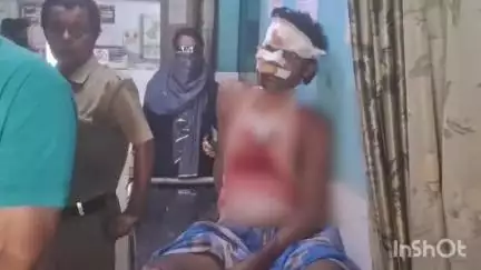 পান্ডুয়া: বৈঁচির শিয়ালাগুরি এলাকায় অটো সঙ্গে মোটরবাইকের মুখোমুখি সংঘর্ষে গুরুতর আহত ২,