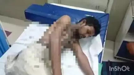 बहराइच: मोतीपुर थाना क्षेत्र के गायघाट चौराहे के पास बंदर भगाने की कोशिश में युवक को लगा करंट, बुरी तरह झुलसा युवक