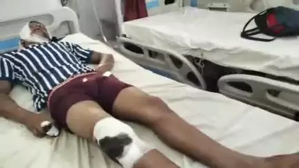सीतापुर: कटीली के पास तेज रफ्तार मोटरसाइकिल ने खड़े हुए ट्रक में टकराई, एक व्यक्ति घायल, इलाज जारी