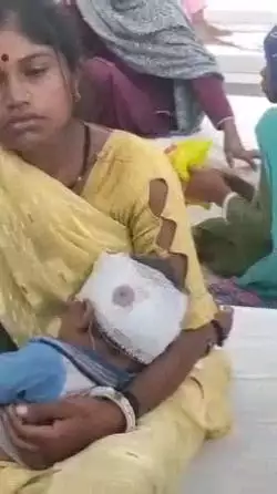 कोटकासिम: जोडिया गांव में कुत्ते ने मासूम भाई-बहनों पर किया हमला, 9 महीने के बच्चे को घसीटते हुए ले गया